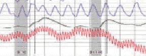 Pomona polygraph